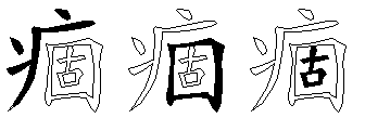 痼