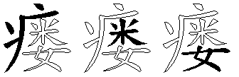 瘘