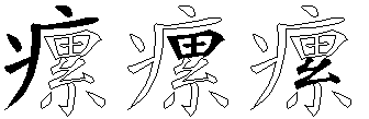 瘰