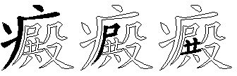 癜